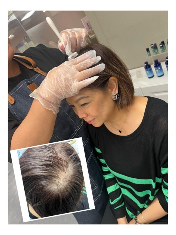 Calecim Advanced Hair System 育髮系統1盒5支 另加1支 跟一次育髮療程：圖片 2