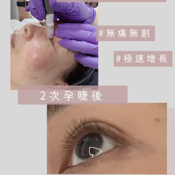 Lashes regrowth 孕睫療程 4 次
