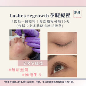 Lashes regrowth 孕睫療程 4 次