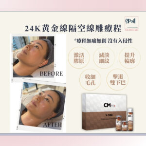 24K黃金線隔空線雕療程