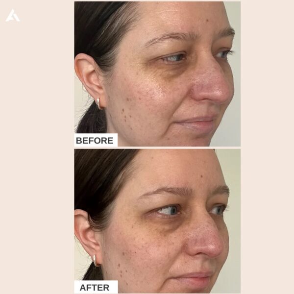 Alpha-H Firming Collagen Repair Cream 緊緻膠原蛋白修護面霜 50ml：圖片 3