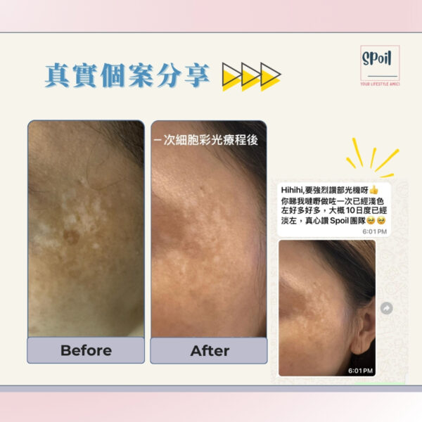 Cell Light 蜂巢細胞光療程 - 首次優惠 (按金$500)：圖片 4