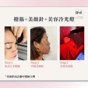 撥筋+美顏針+美容冷光燈 - 首次優惠