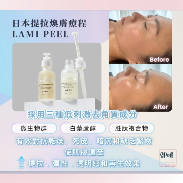 LAMI PEEL 日本提拉煥膚療程 - 首次優惠 (按金$500)：圖片 2
