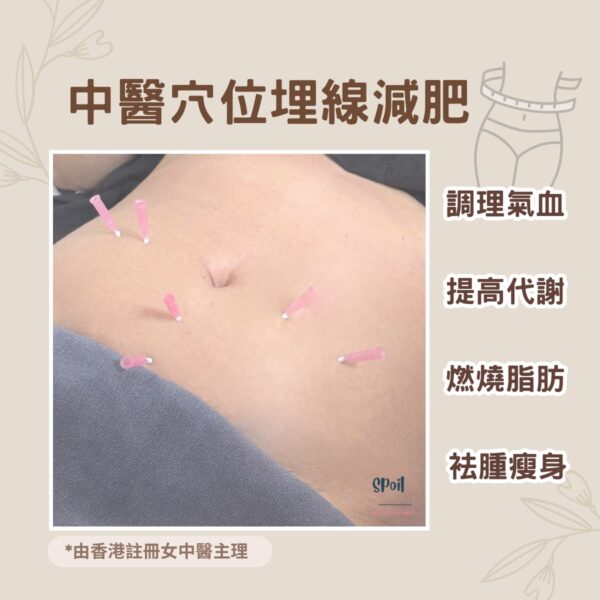 中醫穴位埋線減肥