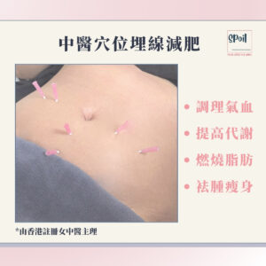 中醫穴位埋線減肥 - 首次優惠 (按金$500)